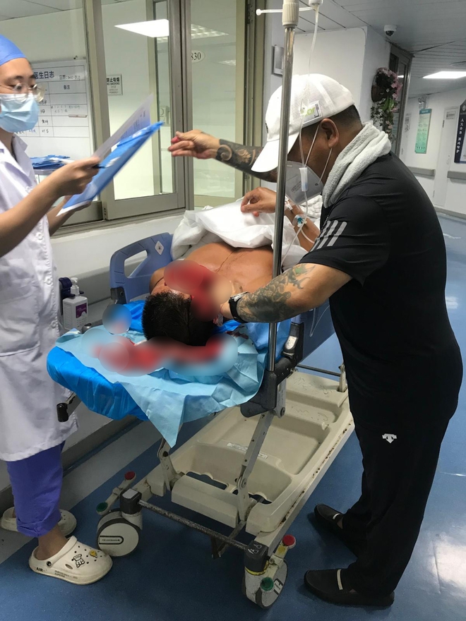 Kinh hoàng vụ nam diễn viên bị "con nghiện" chém trọng thương, phải khâu hơn 100 mũi khắp cơ thể- Ảnh 2.
