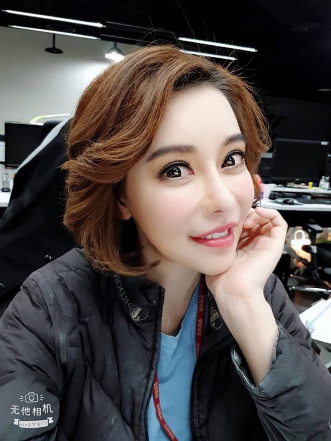 Nữ diễn viên không đánh răng suốt 1 năm (?!): Hứng chịu hậu quả kinh hoàng, lí do gây bất ngờ- Ảnh 5.