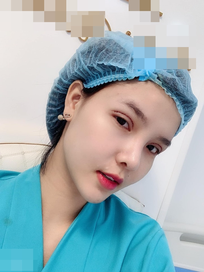 Mộng Điệp vợ cầu thủ Mạc Hồng Quân sửa mũi 4 lần vẫn bị chê lệch, có lần sửa 7 triệu 20p là xong- Ảnh 5.