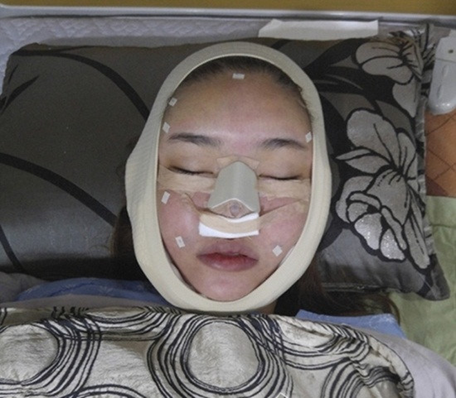 Mộng Điệp vợ cầu thủ Mạc Hồng Quân sửa mũi 4 lần vẫn bị chê lệch, có lần sửa 7 triệu 20p là xong- Ảnh 4.