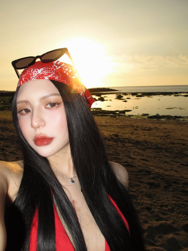 Nữ thần sắc đẹp 29 tuổi qua đời vào sáng nay vì mắc bệnh hiếm gặp- Ảnh 1.