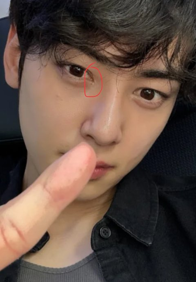 "Thiên tài khuôn mặt" Cha Eun Woo bị nghi phẫu thuật thẩm mỹ: Tài sản quý nhất cũng là giả?- Ảnh 8.