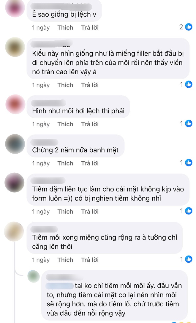 Đôi môi bất thường của Jang Wonyoung - Ảnh 8.