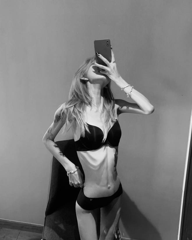 Phát sợ với cơ thể gầy trơ xương, héo mòn của con gái "nữ diễn viên quốc dân"- Ảnh 2.