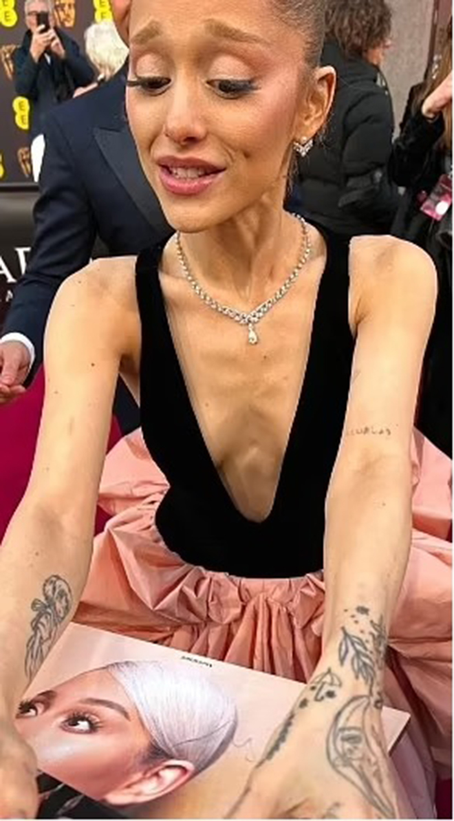 Từ "gái chiến" slay từng bừng, nữ ca sĩ từng bùng kèo fan Việt 8 năm trước nay hốc hác đến trơ xương- Ảnh 13.