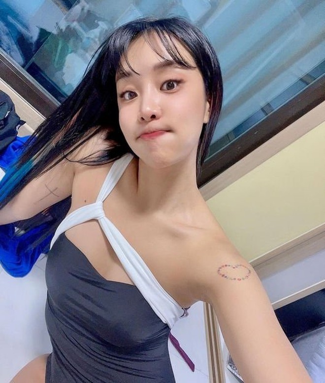 Trùng tu nhan sắc để ăn Tết, 1 sao nữ mặt mũi biến dạng, sưng phồng như bị "500 con ong đốt"- Ảnh 3.