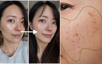 Trị nám tuổi 40 không hề khó nếu bạn bổ sung 2 dưỡng chất này mỗi ngày, phụ nữ trung niên càng nên áp dụng