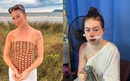 Uống thuốc điều trị trầm cảm, cô gái 23 tuổi gặp phản ứng bị "đốt cháy" từ trong ra ngoài