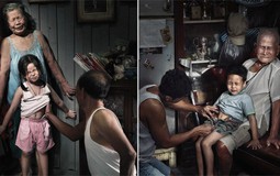 Bộ ảnh gây chấn động: "Nỗi đau theo suốt một đời"