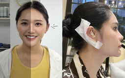 Cô gái khổ sở 30 năm vì tai giống Đoàn Di Băng