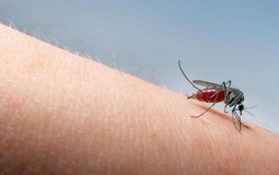 Muỗi chọn “nạn nhân” như thế nào? Lý do khiến một số người bị đốt nhiều hơn hẳn người khác