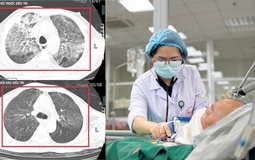 Từ Thái Lan trở về mang theo "vi khuẩn tử thần": Người đàn ông 35 tuổi suy đa tạng nhưng thoát chết kỳ diệu