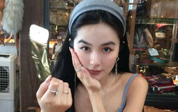 Niềng răng mắc cài kim loại vs mắc cài sứ: Ưu và nhược điểm cần biết trước khi lựa chọn