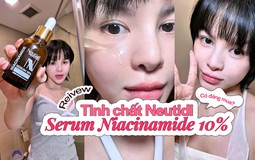 Serum Neutidi Niacinamide 10% có thật sự cải thiện làn da mụn và thâm sạm?
