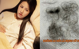 Puka gây lo lắng khi tóc rụng la liệt thành từng mảng sau khi sinh con đầu lòng