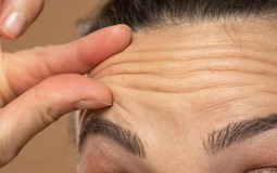Chuyên gia tiết lộ: Ăn gì để xóa nếp nhăn, giảm đầy hơi và đánh bay “sương mù não” do stress?