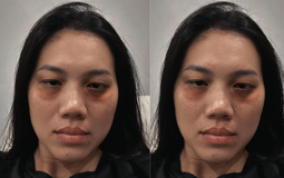 Dụi mắt không nhận ra Ánh Viên, sao lại ra nông nỗi này?