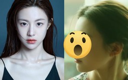 Mỹ nhân "mặt kim cương" làm mưa làm gió xứ Hàn lộ bằng chứng "dao kéo"?