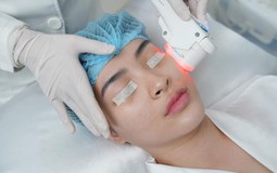 Top 7 công nghệ trẻ hóa da tiên tiến hiện nay