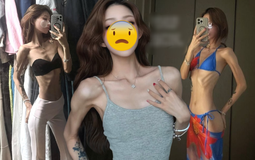 Phát sợ với cơ thể gầy trơ xương, héo mòn của con gái "nữ diễn viên quốc dân"
