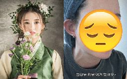 Xót xa mỹ nhân Mặt Trăng Ôm Mặt Trời bị hủy hoại nhan sắc khi mang thai