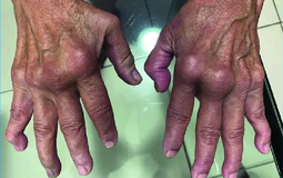 Nóng: Loại virus “phá hủy nội tạng” có thể chuẩn bị bùng phát