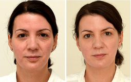 Thử nghiệm uống đủ lượng nước này trong 4 tuần, người phụ nữ 4x trẻ ra 10 tuổi