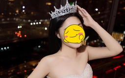 Nữ diễn viên phim giờ vàng tự nhận là visual của công ty, trước nay chưa biết xấu là gì