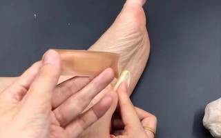 Người phụ nữ 56 tuổi dán tỏi vào lòng bàn chân suốt 6 tháng, kết quả khám sức khỏe khiến bác sĩ "ngã ngửa"