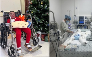 96 ngày giành sự sống của cậu bé 5 tuổi bị cha đốt xăng bỏng đến 80%: “Phép màu từ nghị lực phi thường”