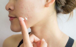 Kem chấm mụn có thực sự cần đến hoạt chất treatment mạnh mới đem lại hiệu quả?